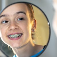 Caucasian preteen girl with braces on her teeth looking at the mirror, perfect smile concept.